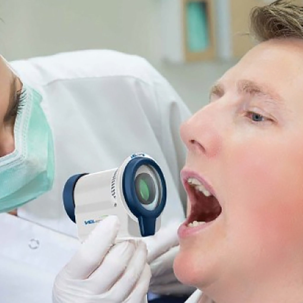 oral cancer screening velscope examinaiton
